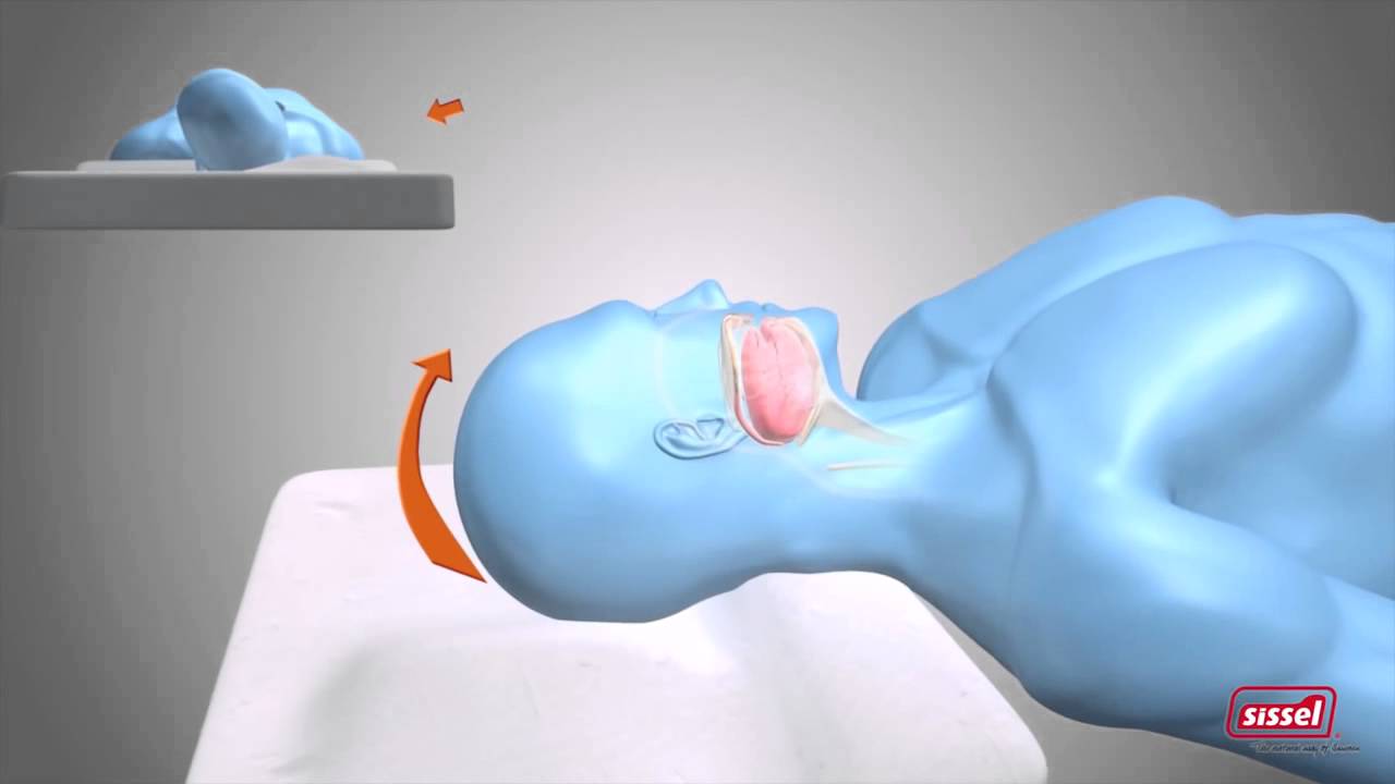 Less Snoring Antisnoring pillow sissel silencium less snoring immediately - YouTube