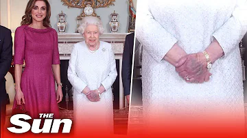 The Queen's hand pictured purple sparking concern worldwide