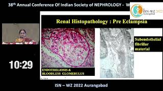 Pathogenesis and Management of AKI in Pre-eclampsia screenshot 4
