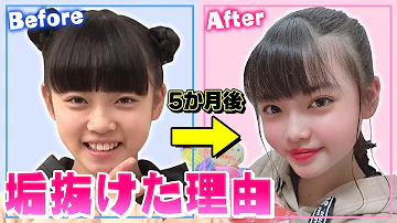 中学生女子メガネ前髪薄く見せる 中学生女子メガネ前髪薄く見せる