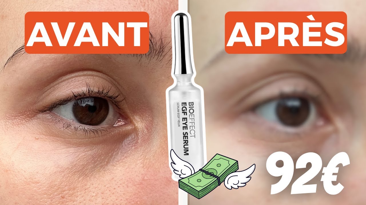 J’ai testé le sérum yeux Bioeffect pendant 3 mois : avant / après