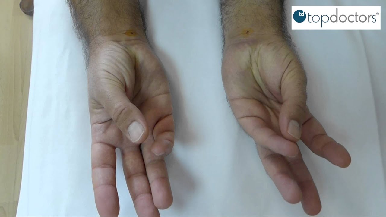 Cirugía Ecoguiada - Qué es la Cirugía Ecoguiada traumatologia pediatrica