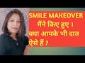 कुछ SMILE MAKEOVER मैंने किए हुए । क्या आपके भी दांत ऐसे है?