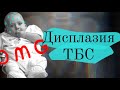 Дисплазия тазобедренного сустава: рентген👶