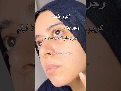 وشي كان داخل على مرحلة انهياراحمرار جفاف والتهاب    اكسبلور