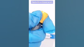 Hepatitis B Surface Antigen Screening Test #laboratory #medtechstudent #cls #m #serology #hepatitisb