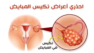 تكيس المبايض من اسباب فشل الحقن المجهري وعلاجة مع د/ عبد المعطي السمنودي