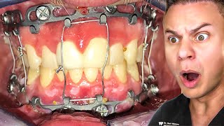 TikToks That Will Make You Want Braces