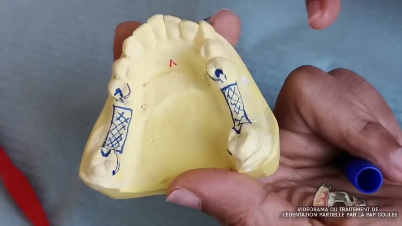 Dr BELLEMKHANNATE samira   ANALYSE SUR PARALLELISEUR