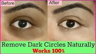 Let&#39;s Talk - Sunburn, Dark Circles Around The Eyes, Photosensitive Skin, Uneven Skin Tone