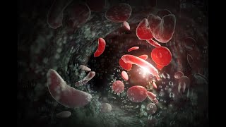 What to know about sickle cell disease | Part 2