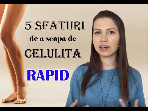 Video: Studiul Patogenității și Severității Lactococcus Garvieae Izolate De Fermele De Păstrăv Curcubeu (Oncorhynchus Mykiss) Din Provincia Kohkilooieh și Boyerahmad