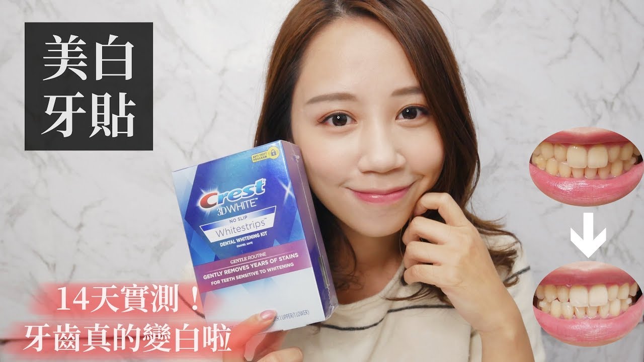 Crest美白牙貼14天實測使用心得！牙齒真的變白了！｜Hanna S.哈娜