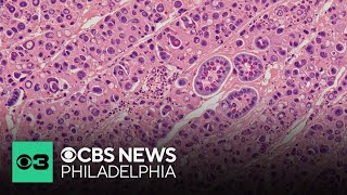 CDC votes to halt Hepatitis B vaccine for newborns