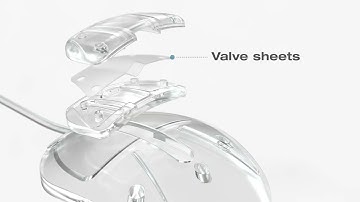 Ahmed® Glaucoma Valve Surgical Animation