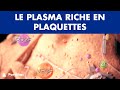 PRP - Plasma riche en plaquettes ©