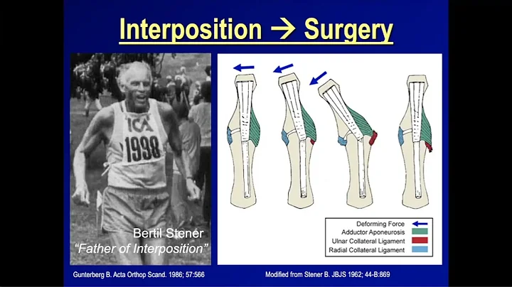 Orthopedic Interposition Injuries: You Only See Wh...