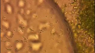 Protozoa and Algae seen under Microscope