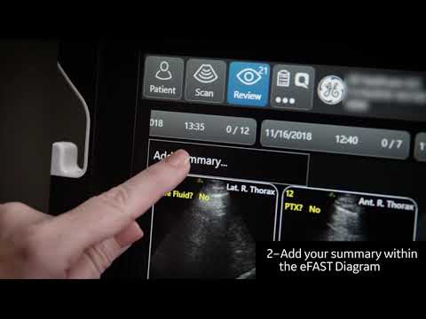 Introducing the eFAST Diagram on Venue™ Family POCUS