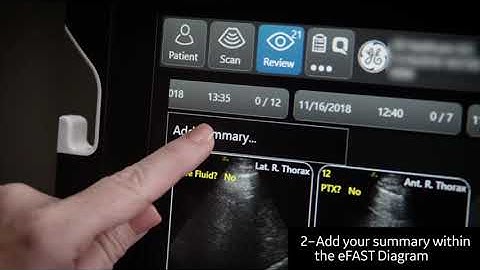 Introducing the eFAST Diagram on Venue™ Family POCUS