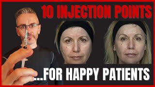 HAPPY PATIENTS! 10 injection points to remove patients' negative 'aura' ​[Aesthetics Mastery Show]