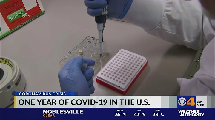 One year of coronavirus in the US