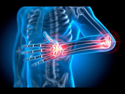 MRCP Endpoints Rheumatology