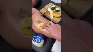 tattoo removal home remedies reality | Tatoo kase hataye | Skinaa Clinic #shorts