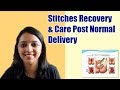 Post Normal Delivery Stitches Recovery & Care Tips