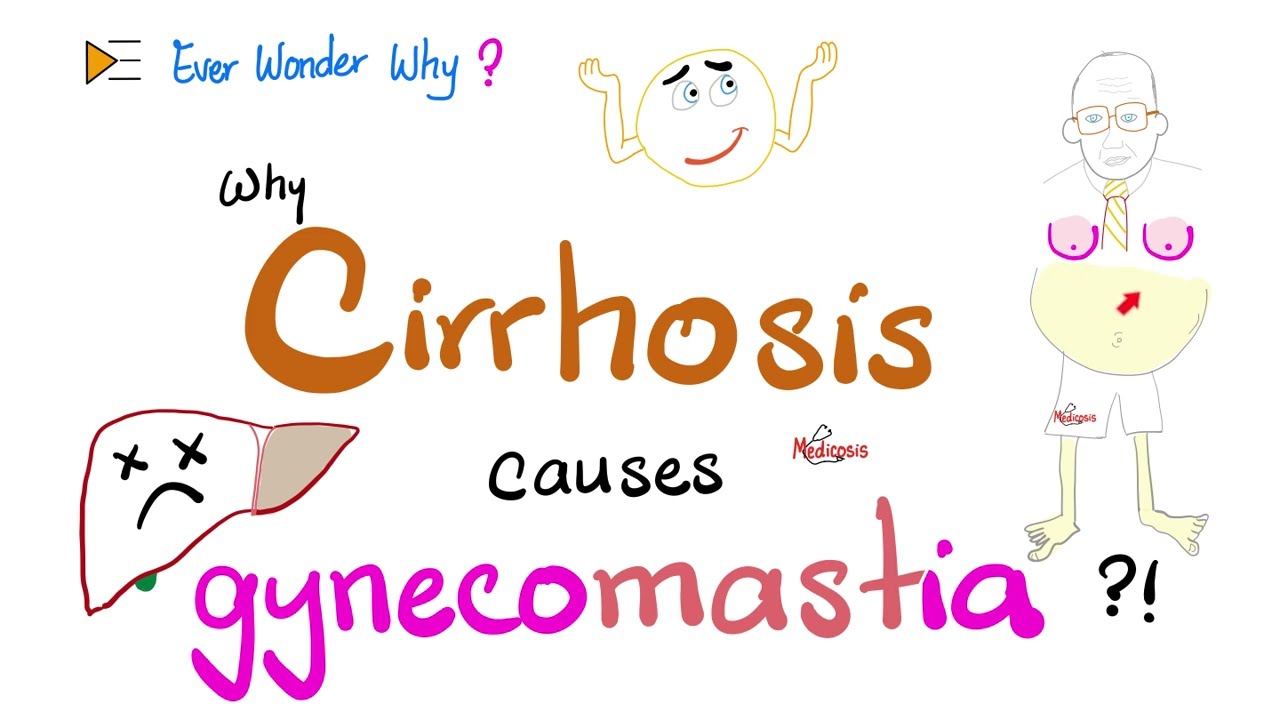 Why Cirrhosis causes Gynecomastia, Spider angiomata, Palmar erythema - Ever Wonder Why?