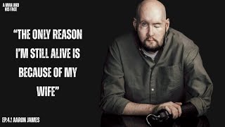 World’s First Face & Eye Transplant | The Man Who Survived the Impossible - Aaron James (Part 1) Details