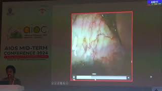 Aiocmt3 2024 Gp55 Topic Dr Nimrita Gyanchand Nagdev Early Interventions Ocular Mage , Sutu
