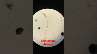 Dog skin mites | Mange | Under microscope viral shorts dog