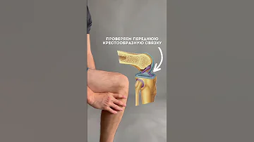 Болят колени? Функциональный тест