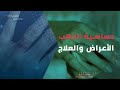 ماهي حساسية الذهب وأعراضها