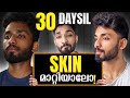 Clear all your skin problems in 30 days scientific guide to remove pimples acne blackhead at home