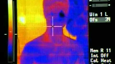 Core and Skin Temperature
