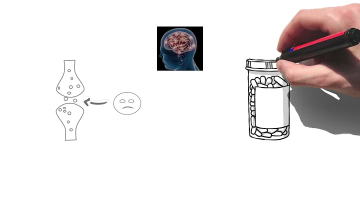 About TMS therapy presented by Rena Ferguson