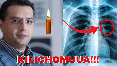 kilichomuua YUSUPH MANJI ni ugonjwa wa U.......