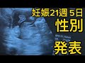 妊娠21週5日‼︎性別発表‼︎不意に告げられビックリしてしまった‼︎#妊娠#vlog