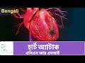 Heart Attack (ACS & MI) | Bengali