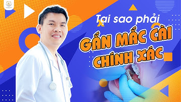 Gắn Mắc Cài Chính Xác - Bước Quan Trọng Để Đảm Bảo Hiệu Quả Niềng Răng | Bác sĩ Trung Long Biên