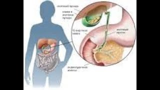 ЗАГОВОРЫ КАМНИ В ЖЕЛЧНОМ ЧИТАТЬ САМОСТОЯТЕЛЬНО САМЫЙ ЛУЧШИЙ СПОСОБ !!!!!!!!!