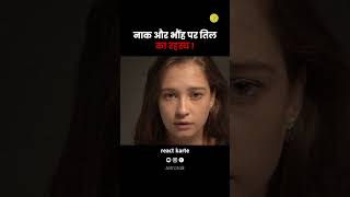 Nose या Eyebrow (भौंह) पर तिल क्या संकेत देता है? | Hidden Secrets of Face Moles You Didn't Know