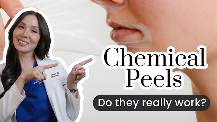 The Do's & Dont's of Chemical Peels