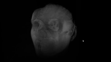 Volume Ray Casting Head