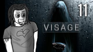 Ткнули в глаз ❥ Visage #11