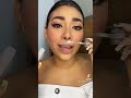 Labios de kylie Jenner versión BARATA?😱👄