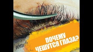 КАК И ЗАЧЕМ НУЖНО УМЫВАТЬСЯ С НАРАЩЕННЫМИ РЕСНИЦАМИ. ПОЧЕМУ ЧЕШУТСЯ ГЛАЗА. РЕКОМЕНДАЦИИ.ГЛАЗНОЙ КЛЕЩ КАК И ЗАЧЕМ НУЖНО УМЫВАТЬСЯ С НАРАЩЕННЫМИ РЕСНИЦАМИ. ПОЧЕМУ ЧЕШУТСЯ ГЛАЗА. РЕКОМЕНДАЦИИ.ГЛАЗНОЙ КЛЕЩ