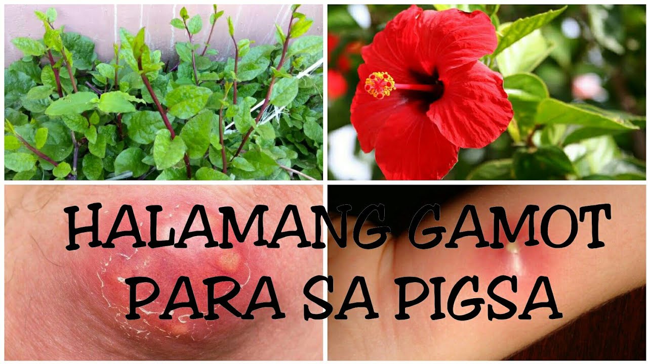 GAMOT SA PIGSA || HALAMANG GAMOT PARA SA PIGSA - YouTube